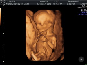 14 weeks ultrasound scan